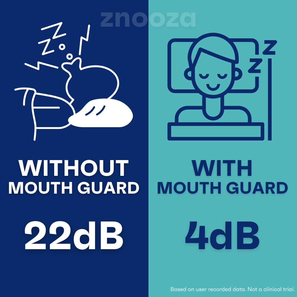 Znooza Anti Snore Comfort Mouth Guard